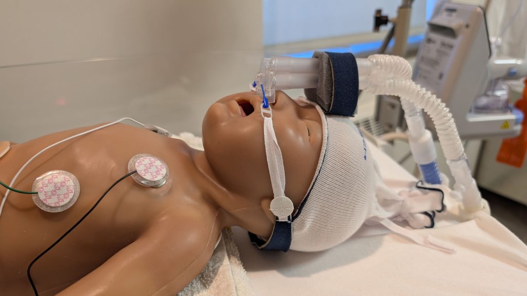 Nouveau-né sous Bubble CPAP à l’Unité de Naissances de Charlevoix.